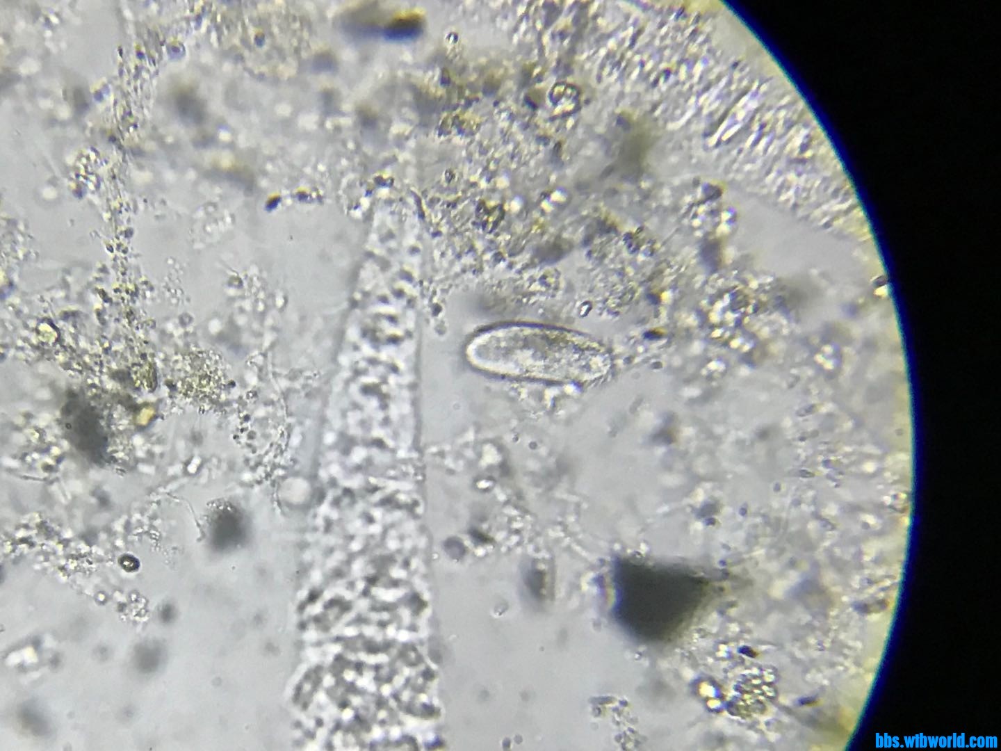 这个镜检中是哪个虫？