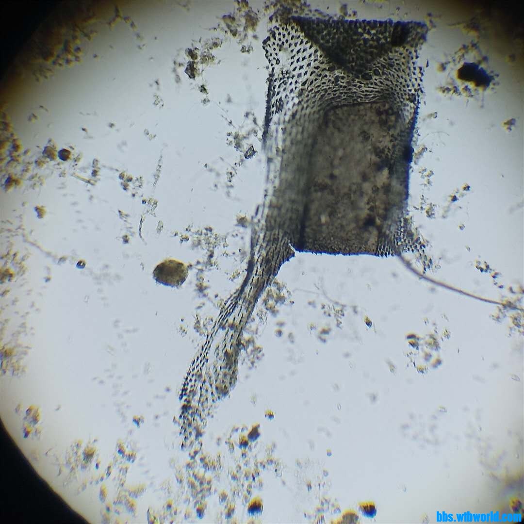 微生物镜检惊现“凶杀案”！