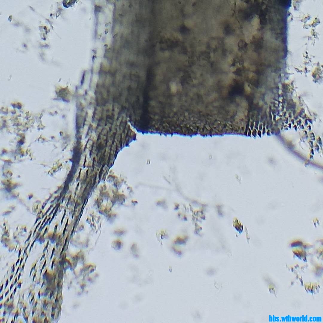 微生物镜检惊现“凶杀案”！