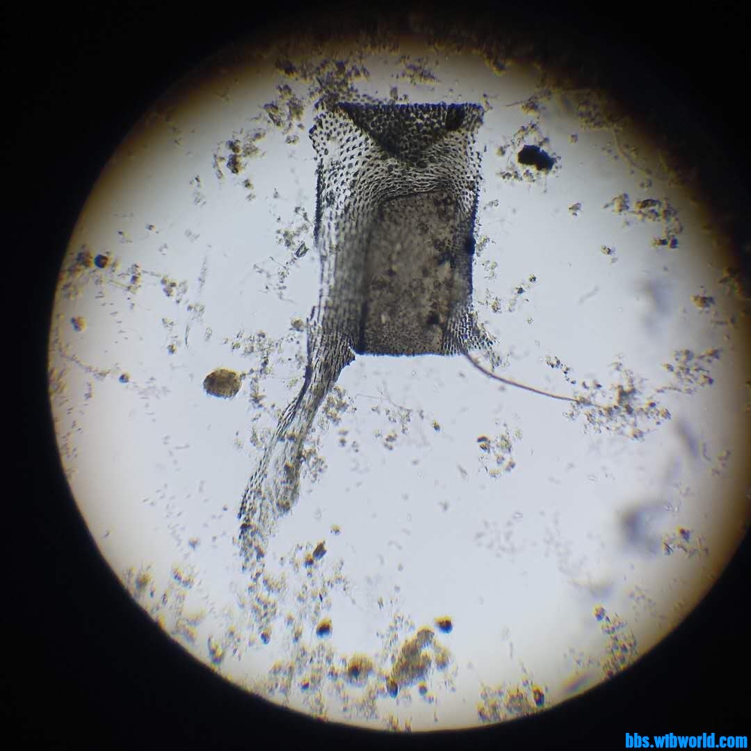 微生物镜检惊现“凶杀案”！