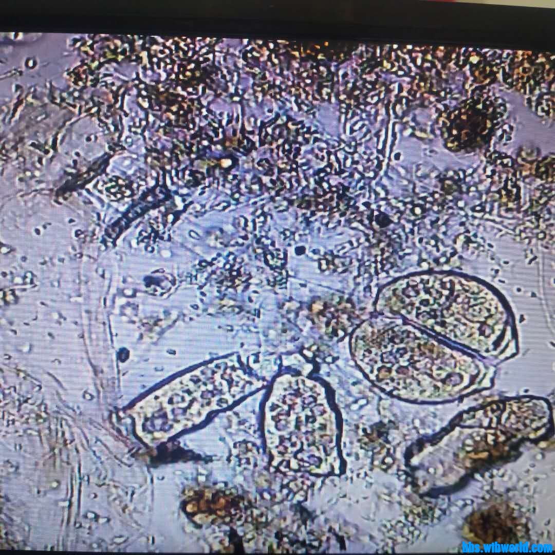 wechat_upload16091256065fe94ee65e9df