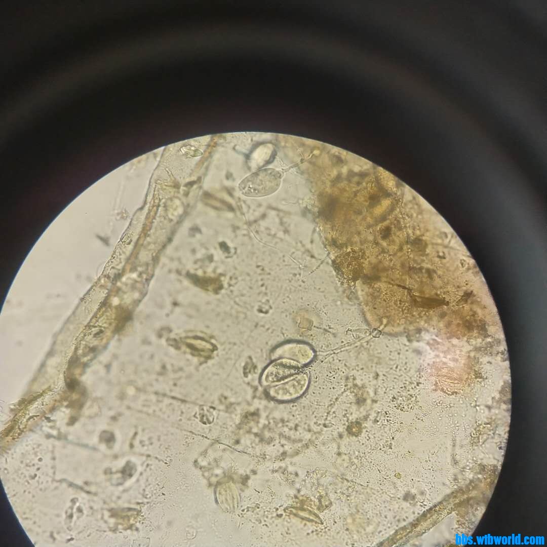 wechat_upload1620011090608f685297517