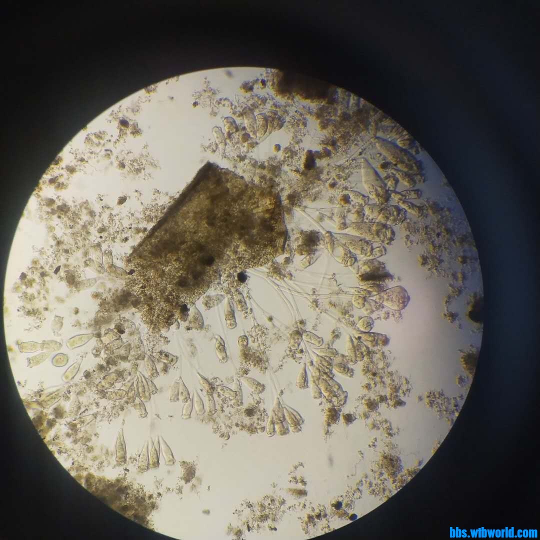 wechat_upload162020158760925073437f4