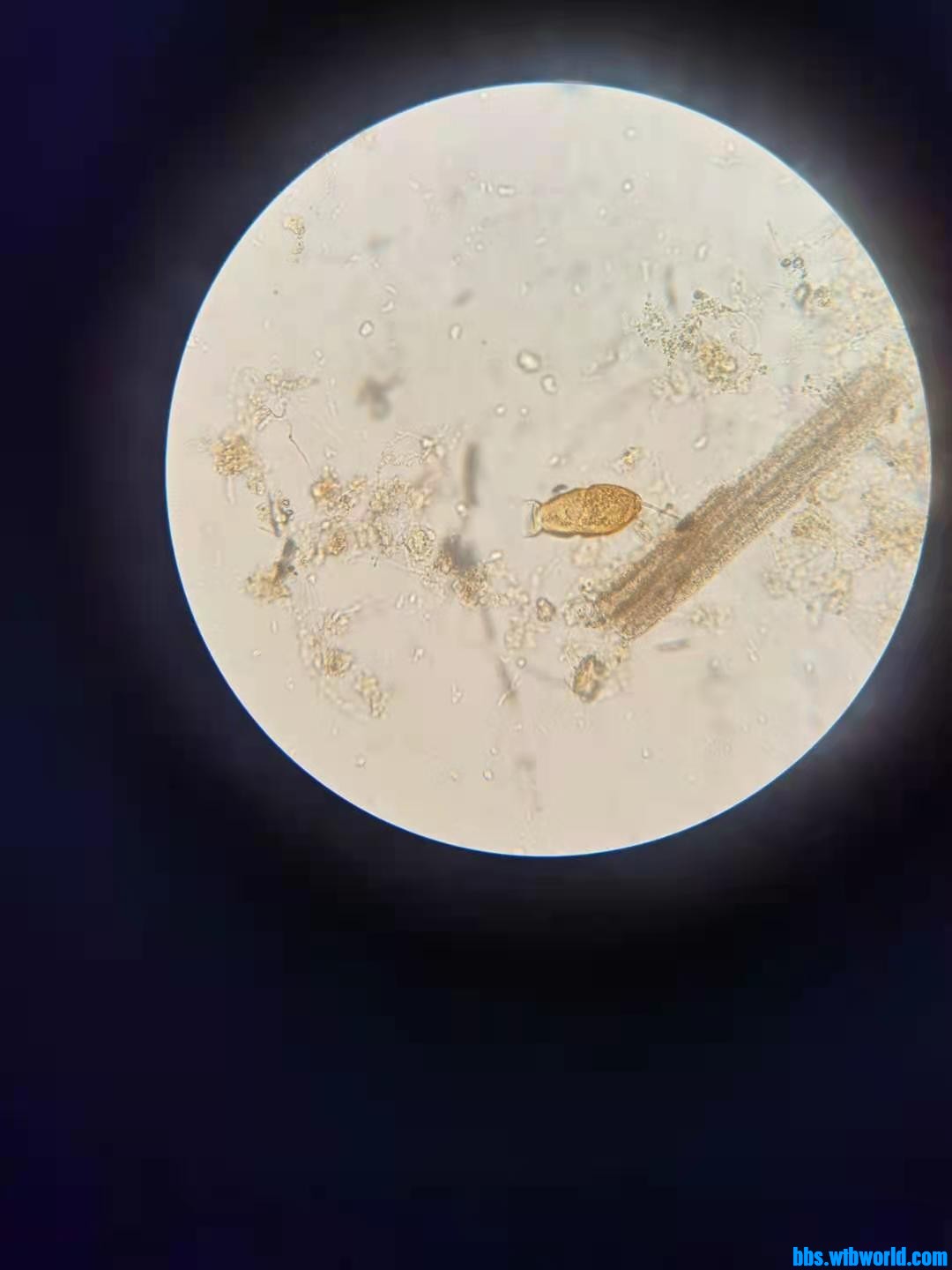 wechat_upload162027087860935f1e810ef