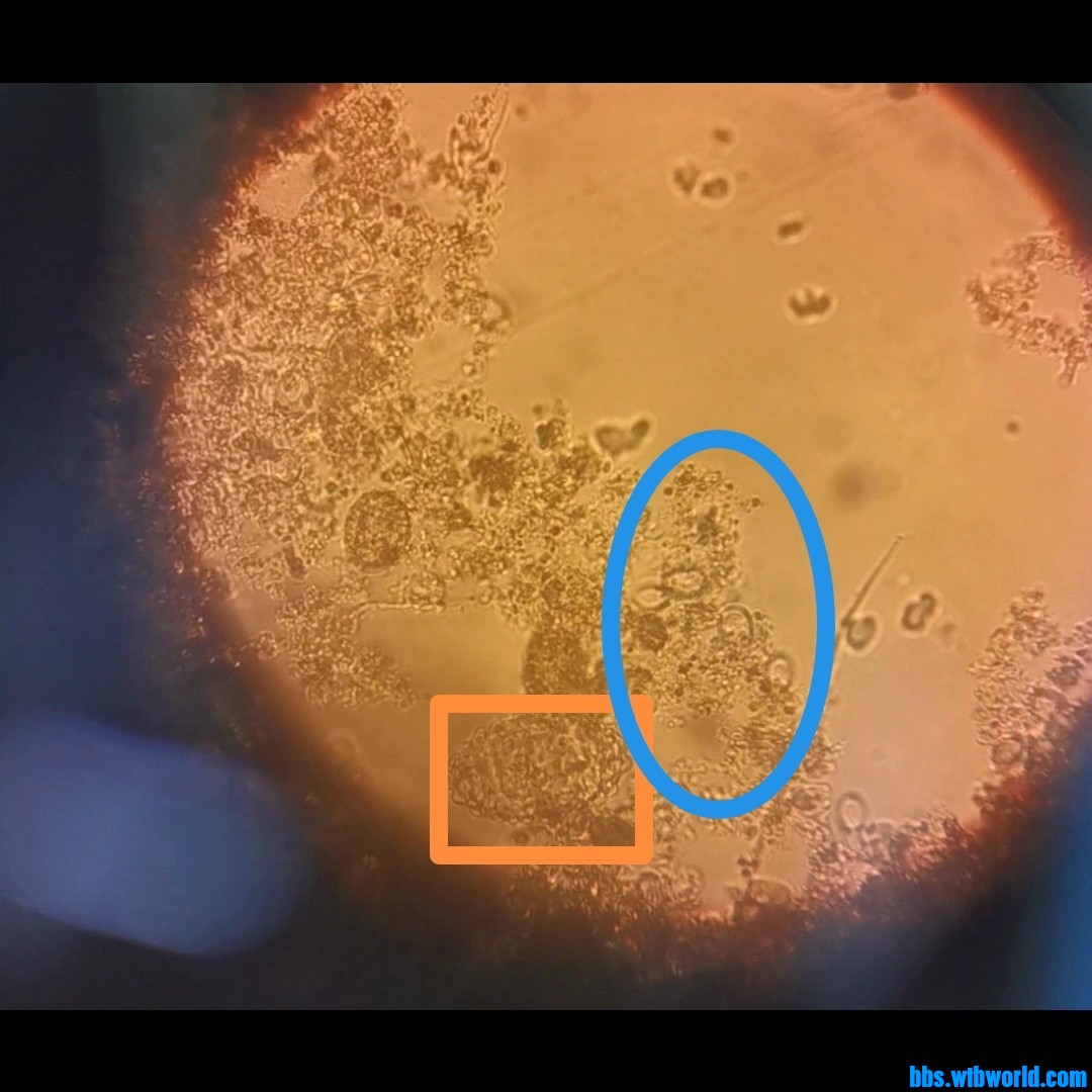 wechat_upload1637830750619f505eccd18