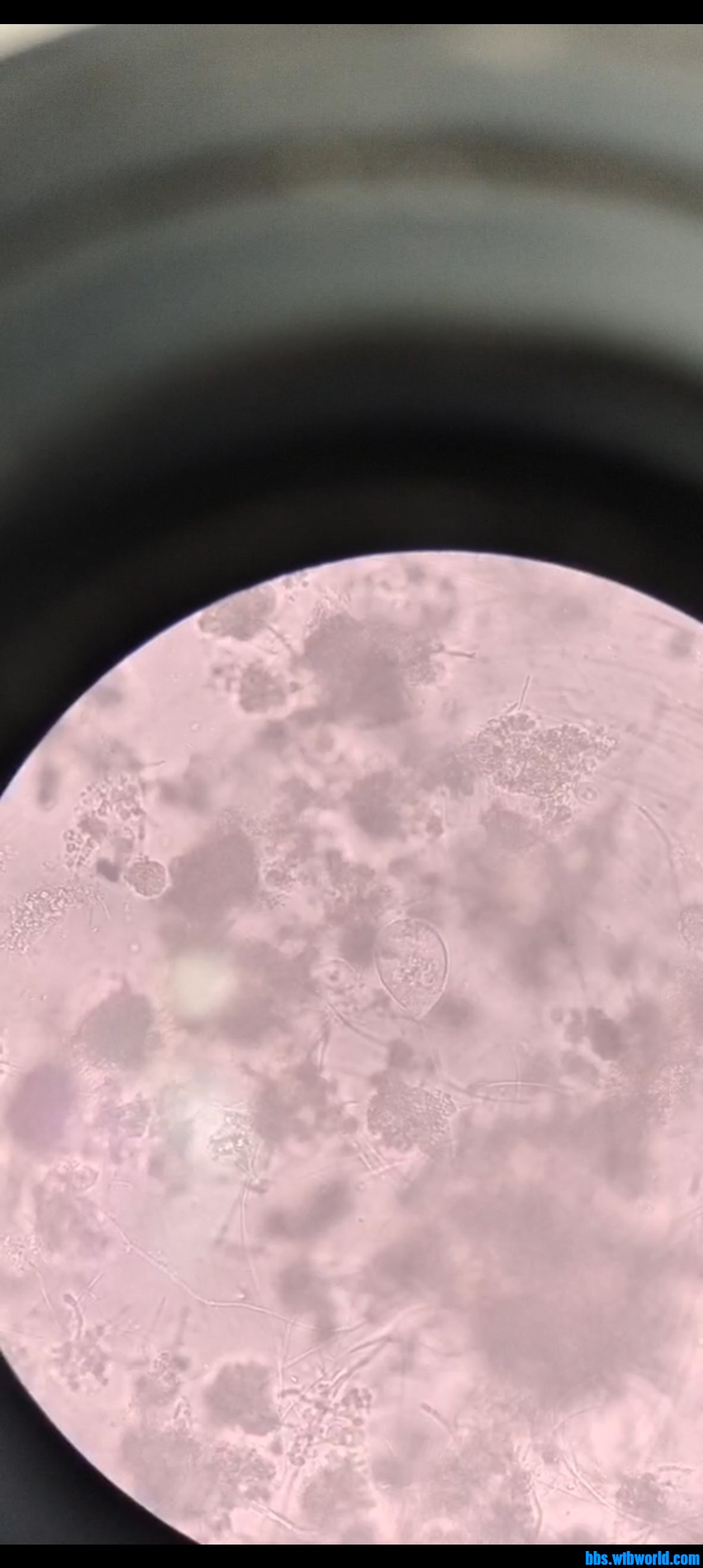 wechat_upload163797672661a18a96bc078