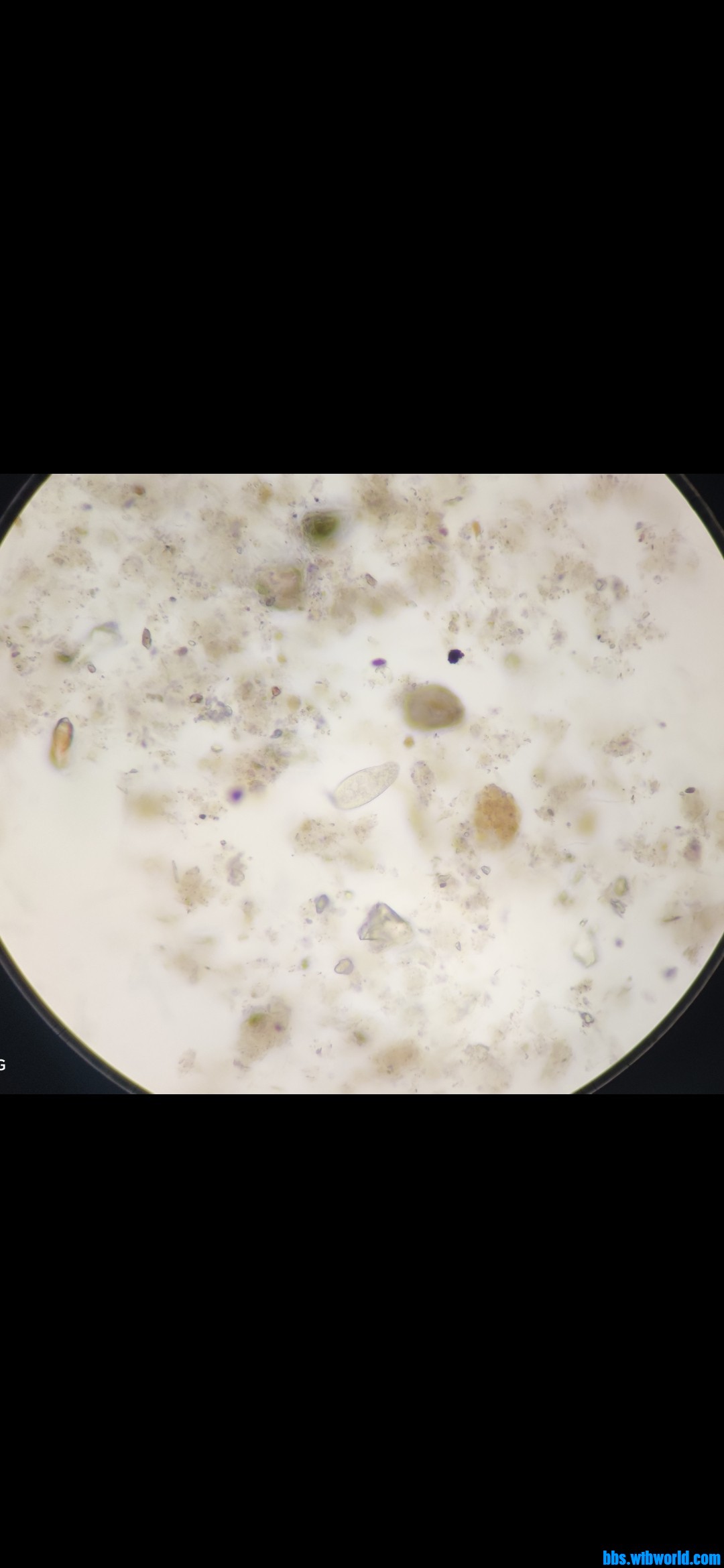 wechat_upload163876032861ad7f88b8bc0