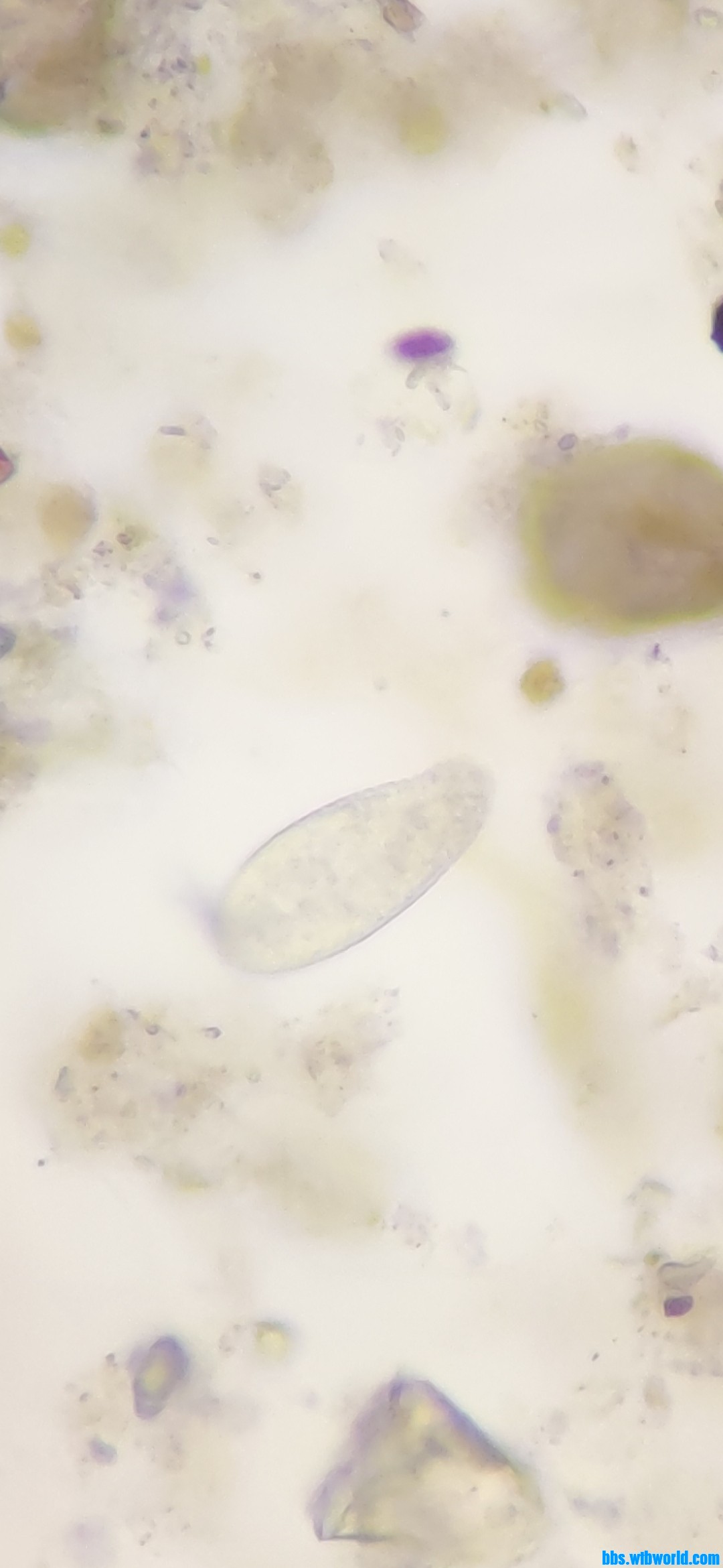 wechat_upload163876032961ad7f893352c