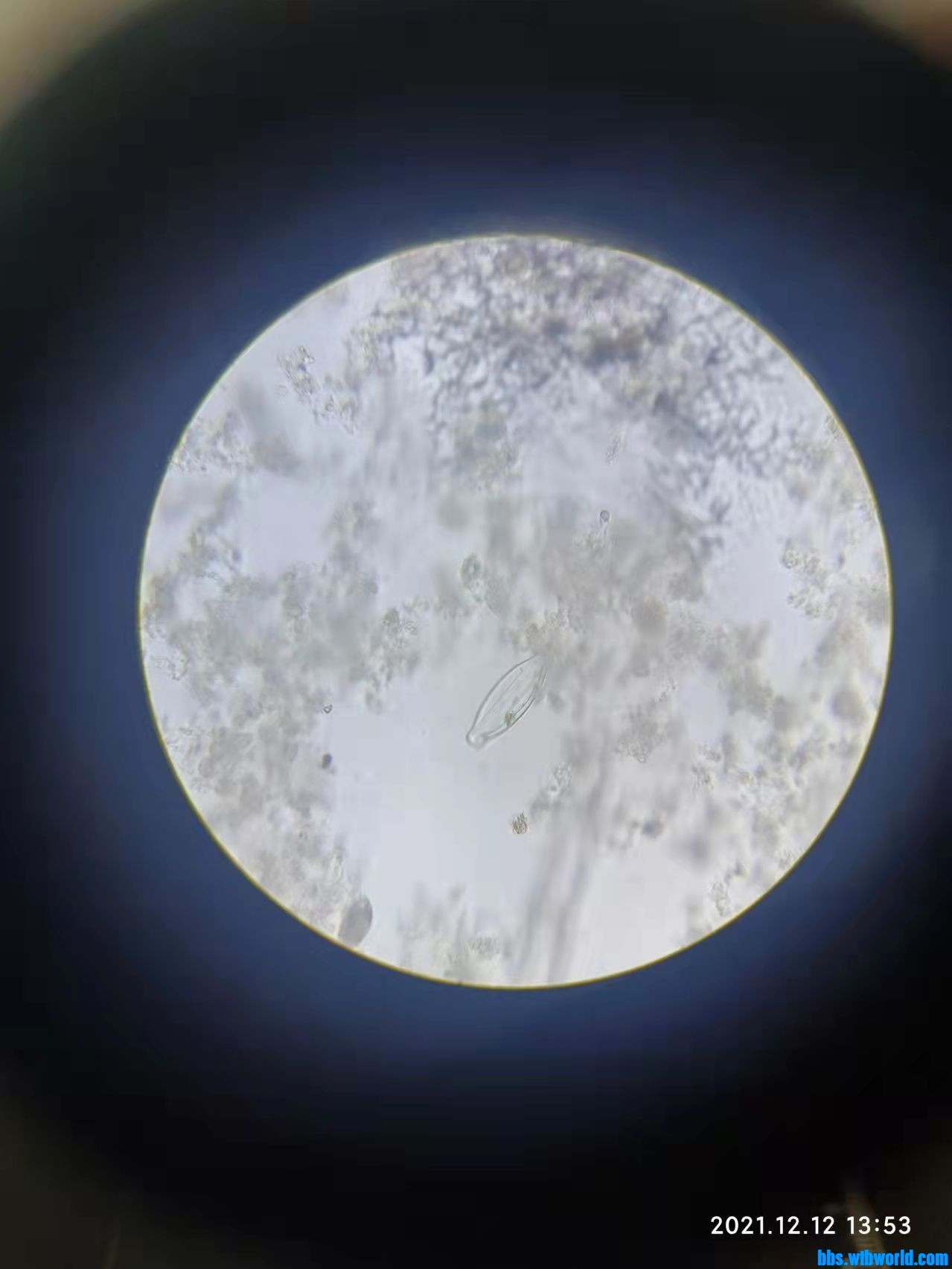 wechat_upload163928884761b5900f5f47a