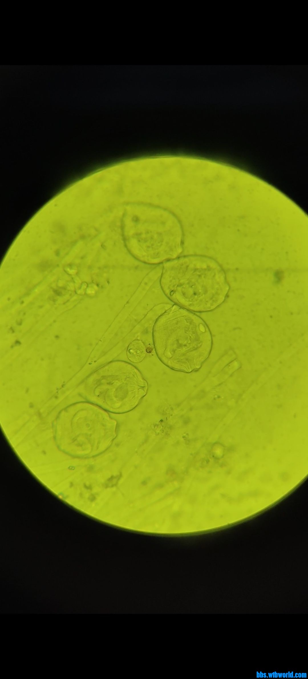 wechat_upload163929114661b5990a7bc04