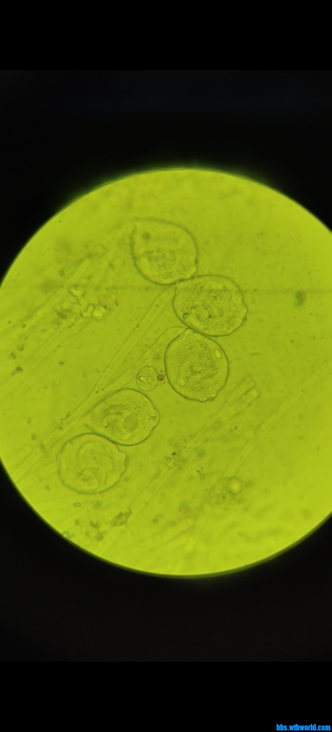 wechat_upload163929114661b5990a2ba2e