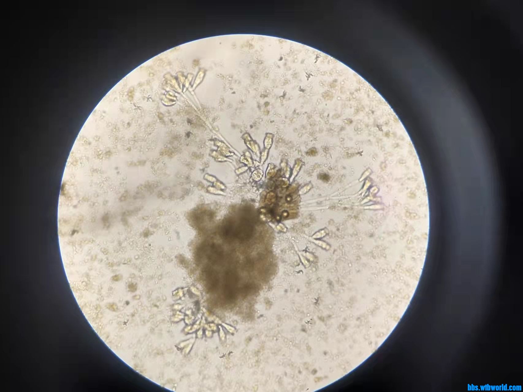 wechat_upload163990415561bef39bd1647