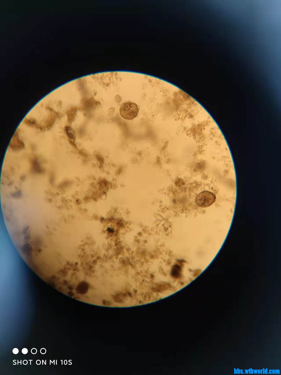 wechat_upload163998858661c03d6aebe1e