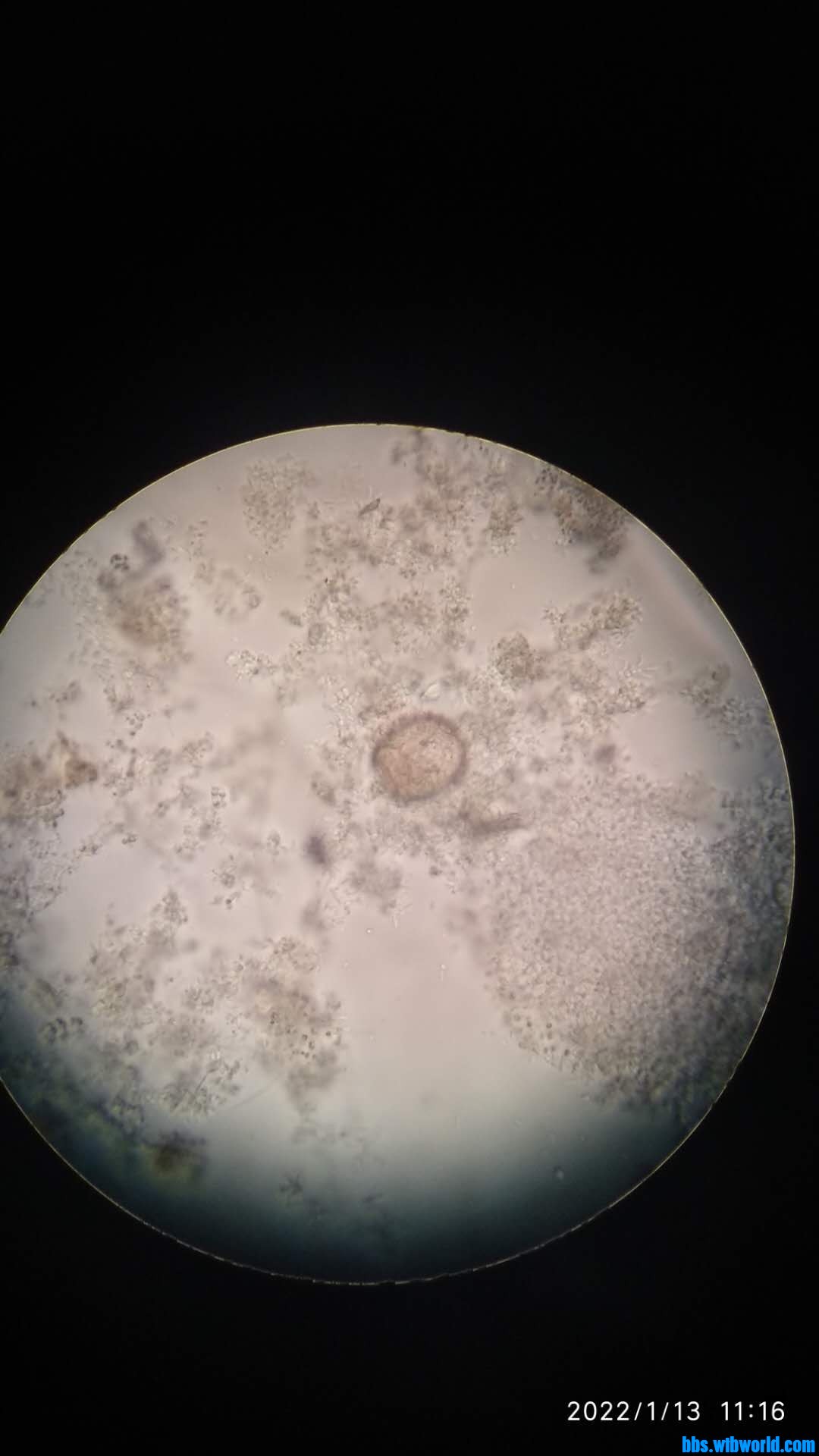 wechat_upload164204464661df9ce678354