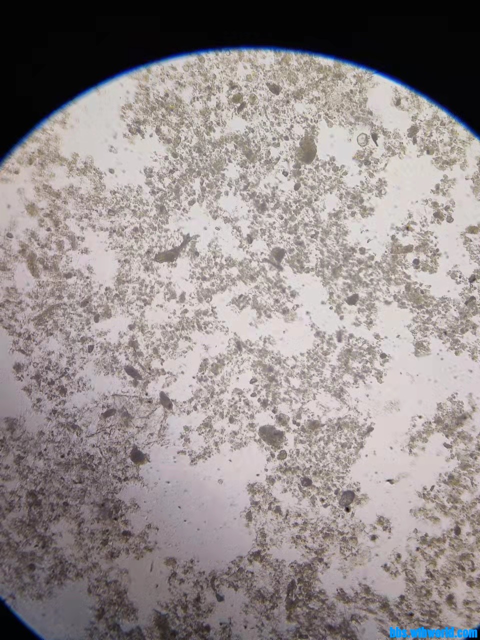 wechat_upload164663186962259bbde91eb