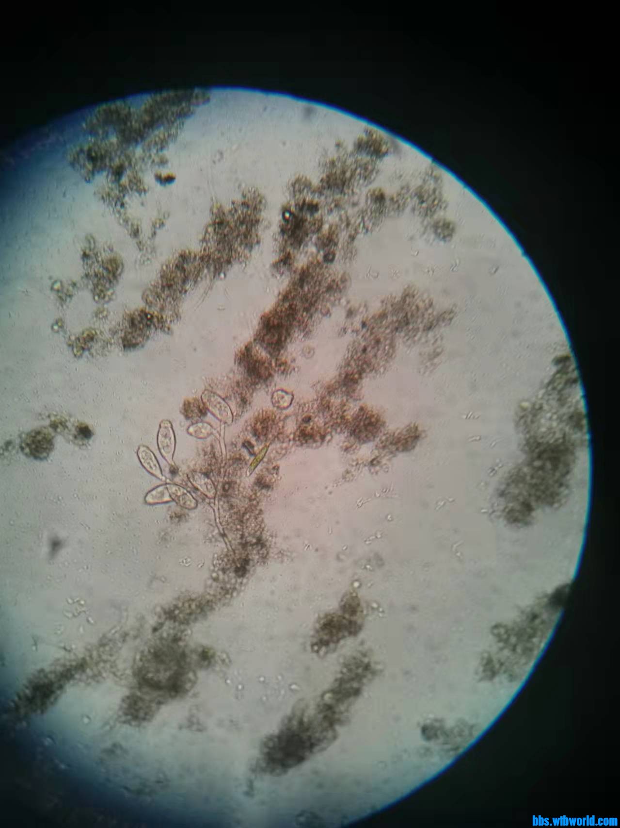 wechat_upload1646975663622adaaf8103e