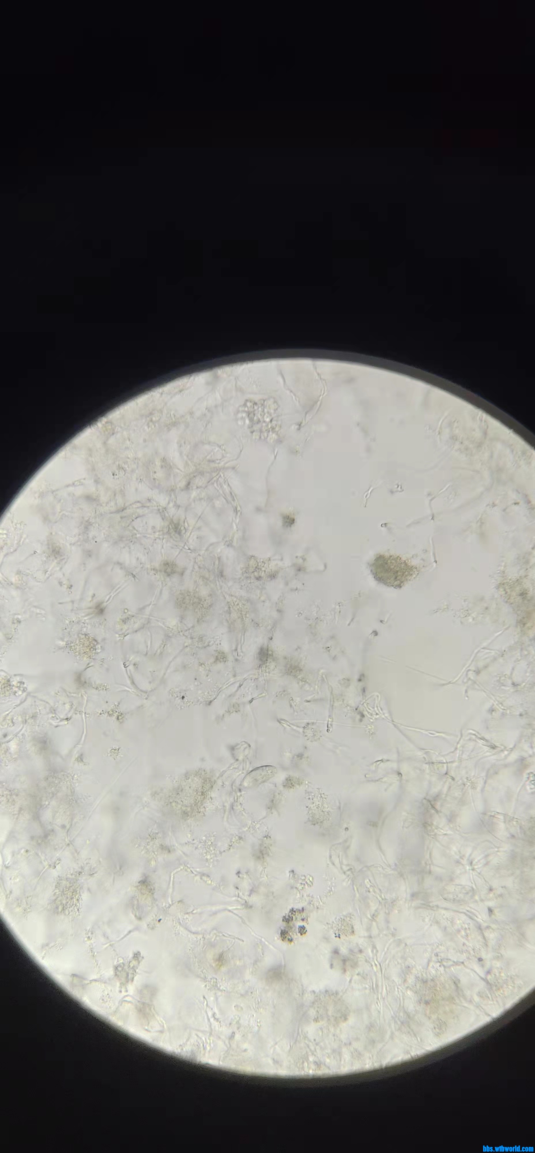 wechat_upload16475882296234338586dae