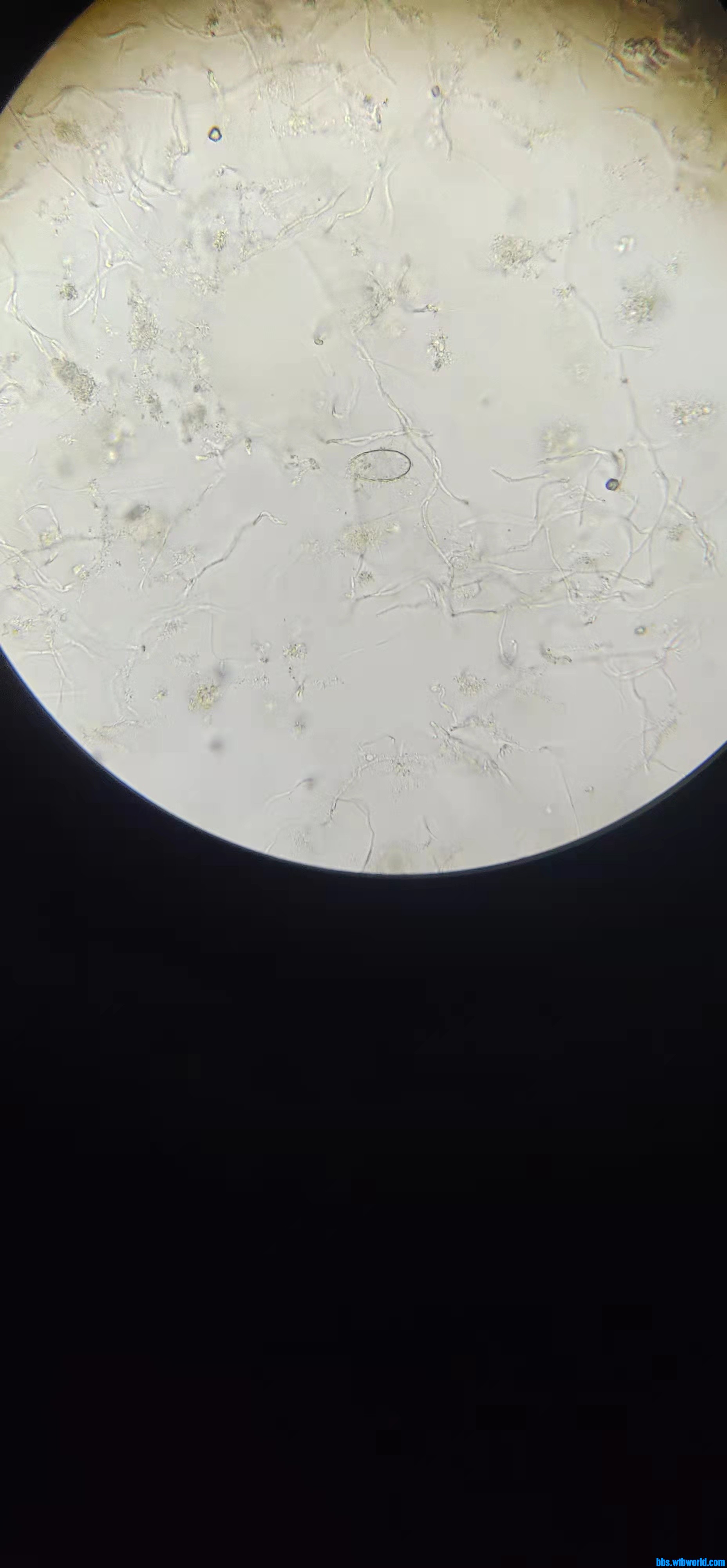 wechat_upload164758823162343387e86dd