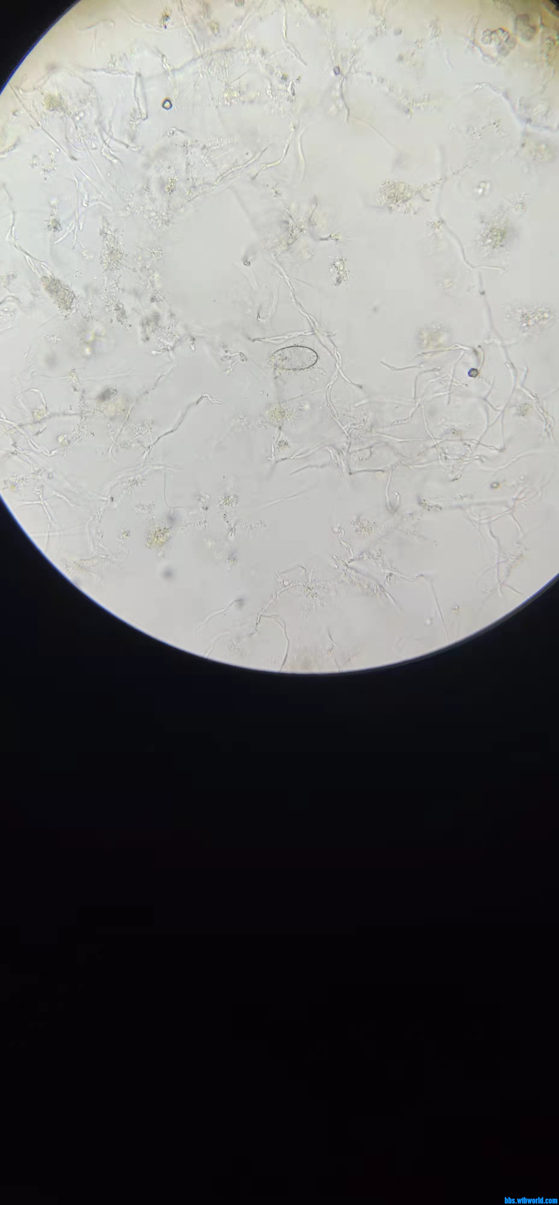 wechat_upload16475882346234338a427dc