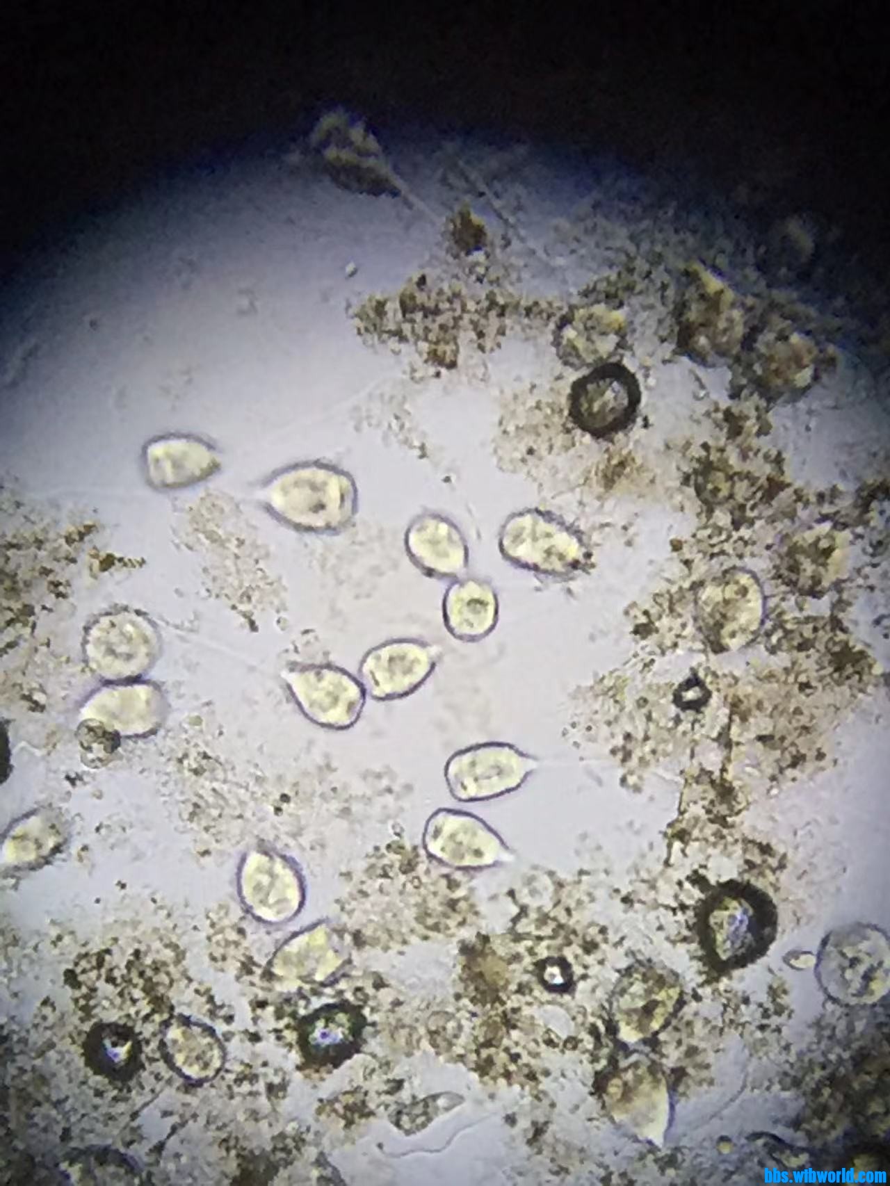 wechat_upload164759939262345f20d84de