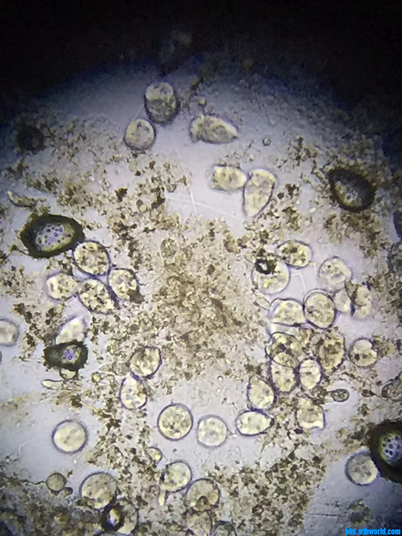 wechat_upload164759939362345f2145f7a