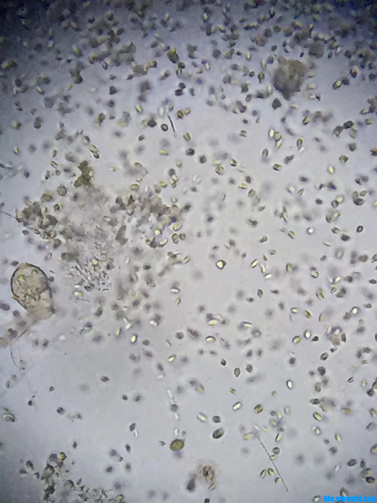 wechat_upload1647599811623460c34a871