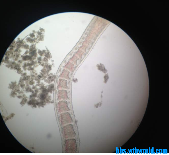 wechat_upload164774435262369560a9e61