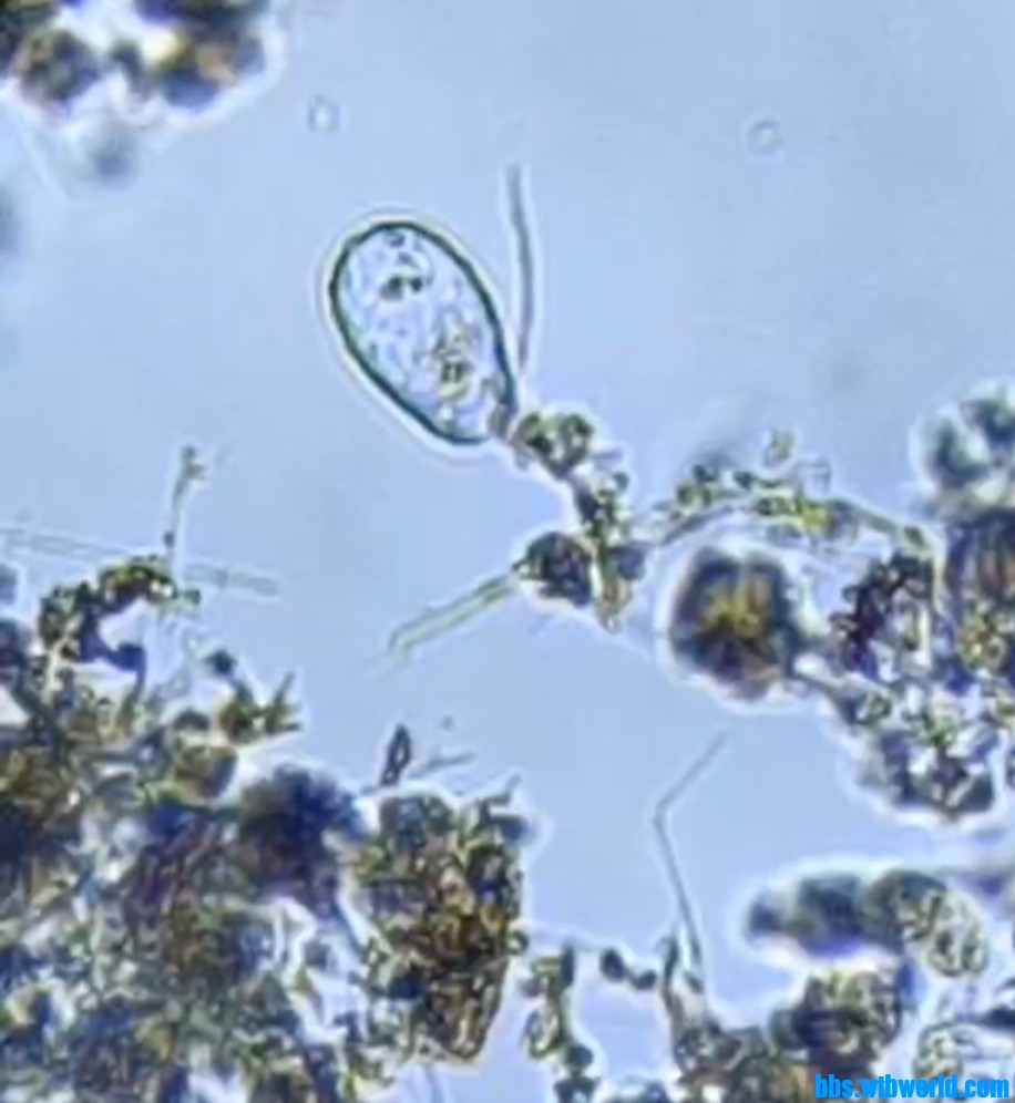 wechat_upload1648082623623bbebf096ca