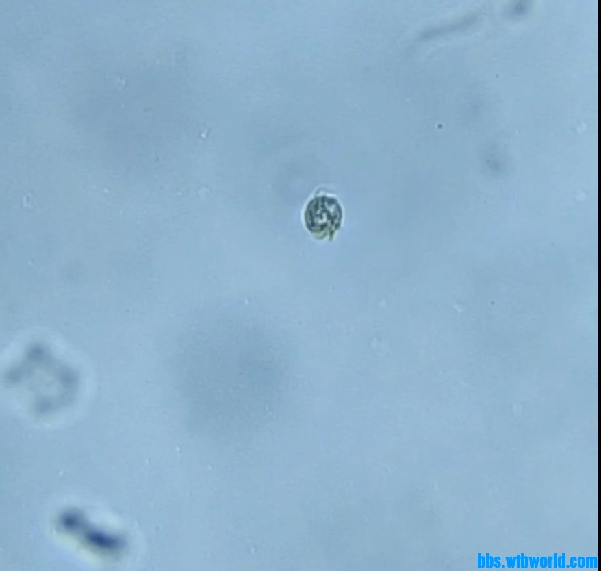 wechat_upload164856098462430b58b0928