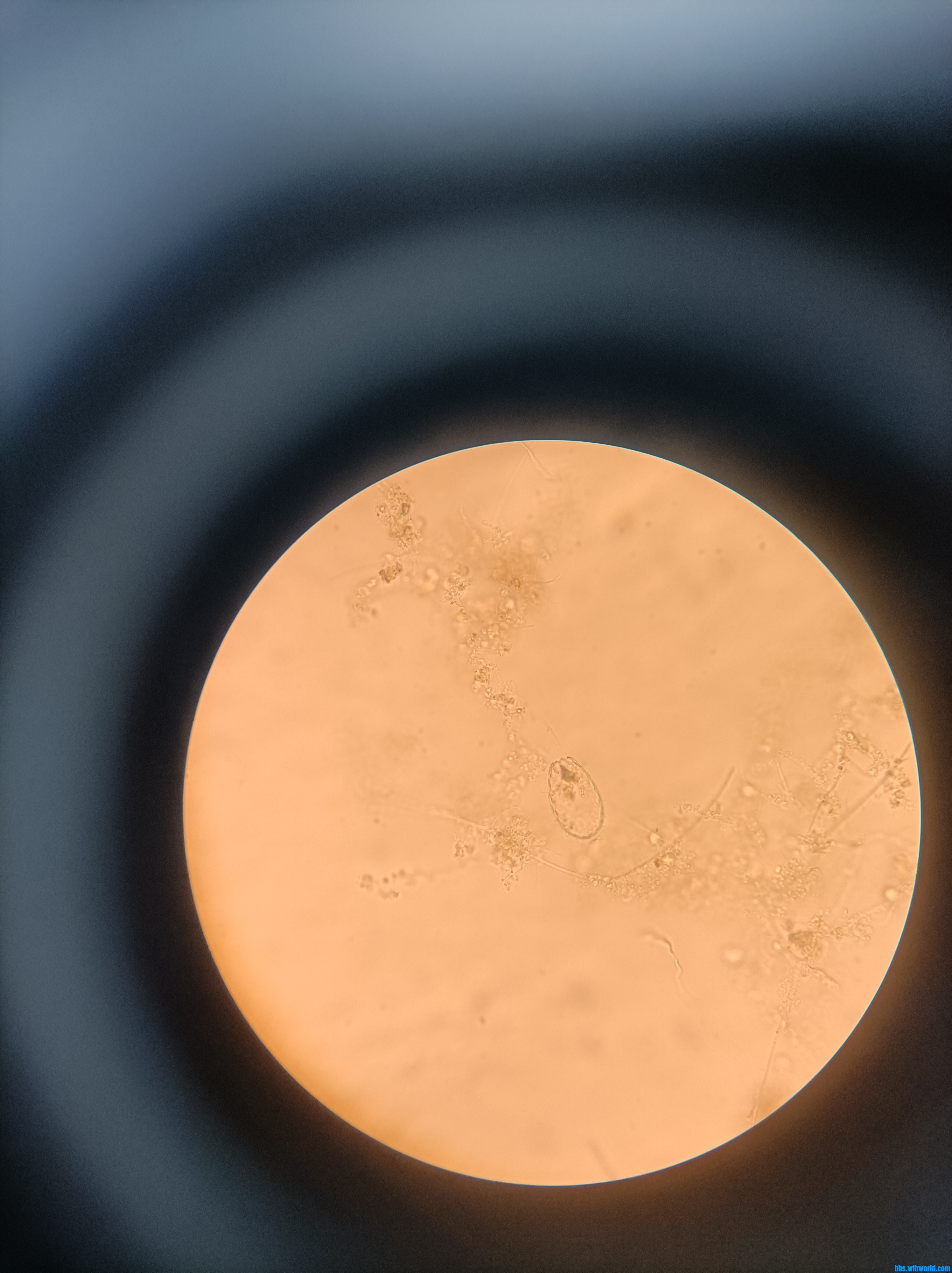 wechat_upload1649171399624c5bc7e75ea