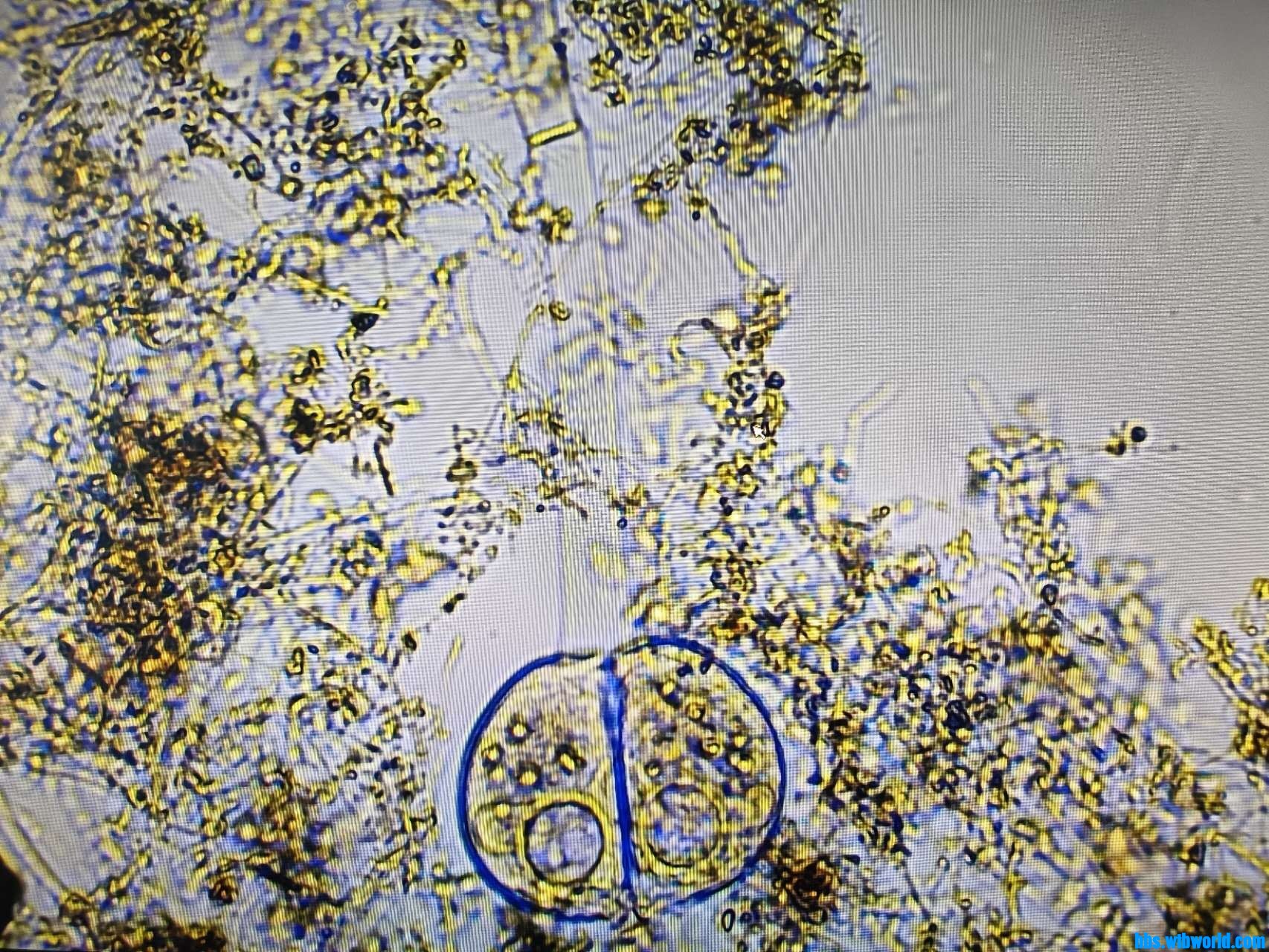 wechat_upload165762095462cd49dadc7f4