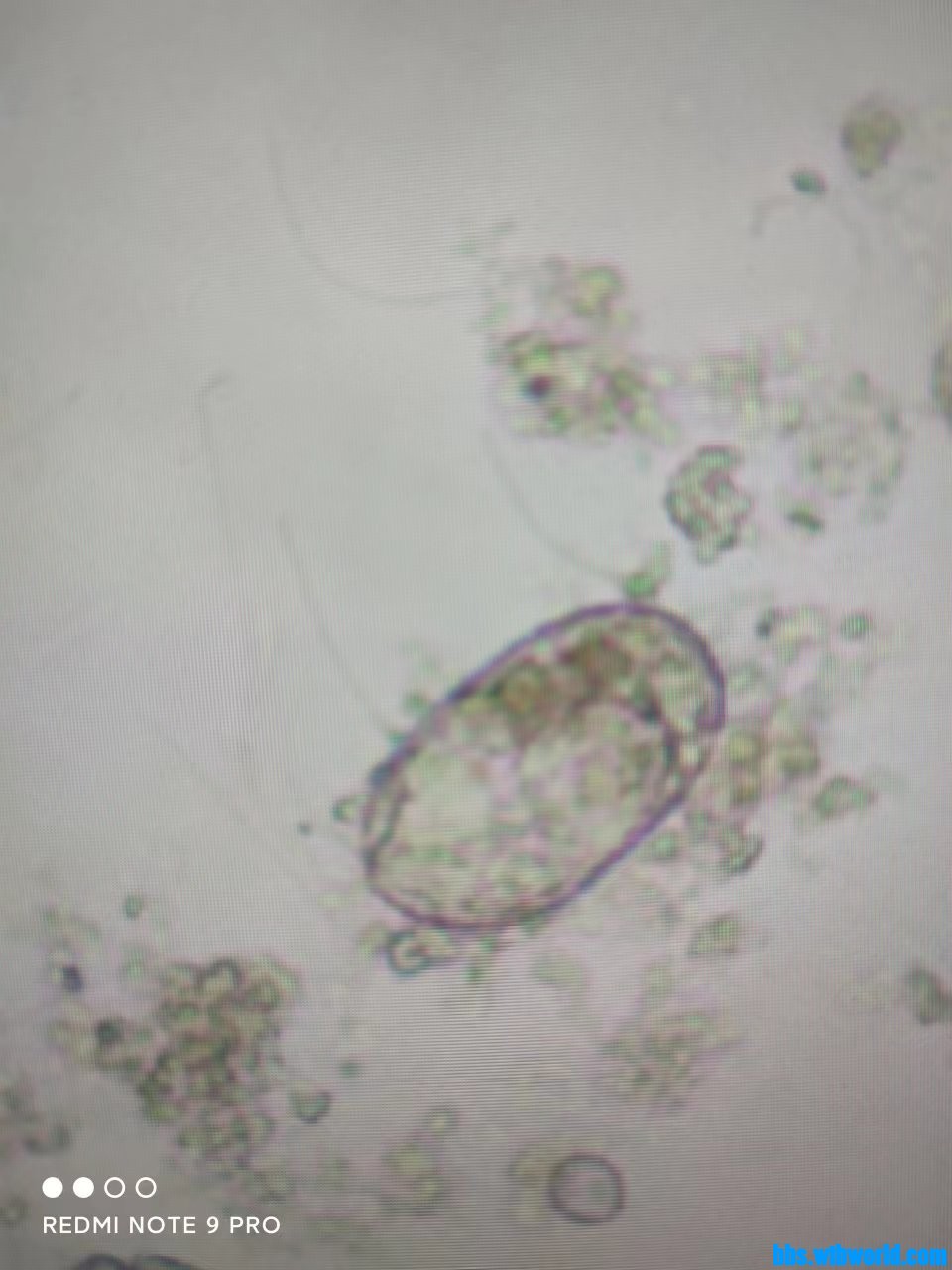 wechat_upload165771382562ceb4a169643