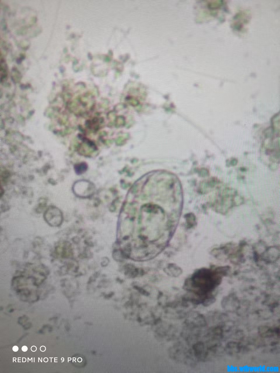 wechat_upload165771382562ceb4a128f33