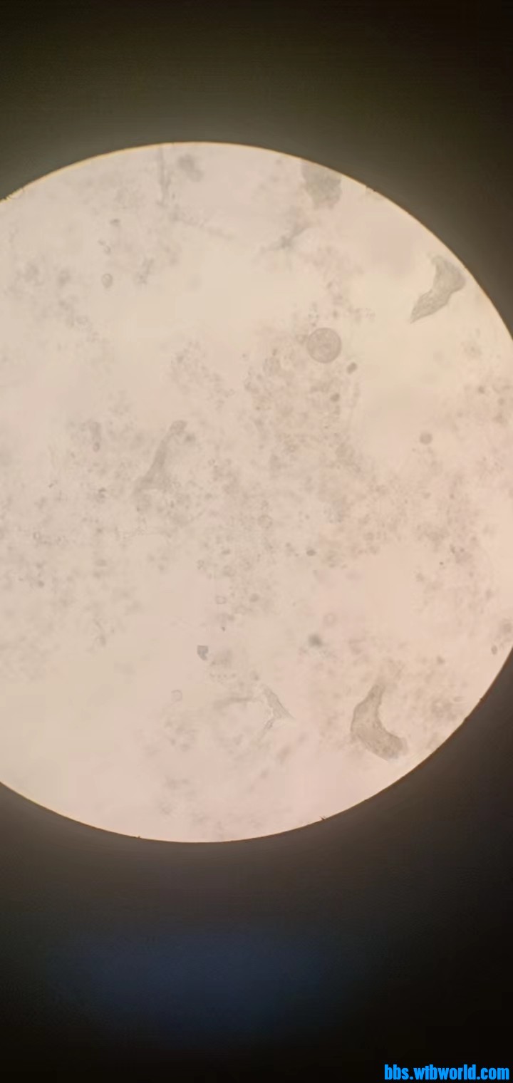 wechat_upload166340886563259ae18a9fa