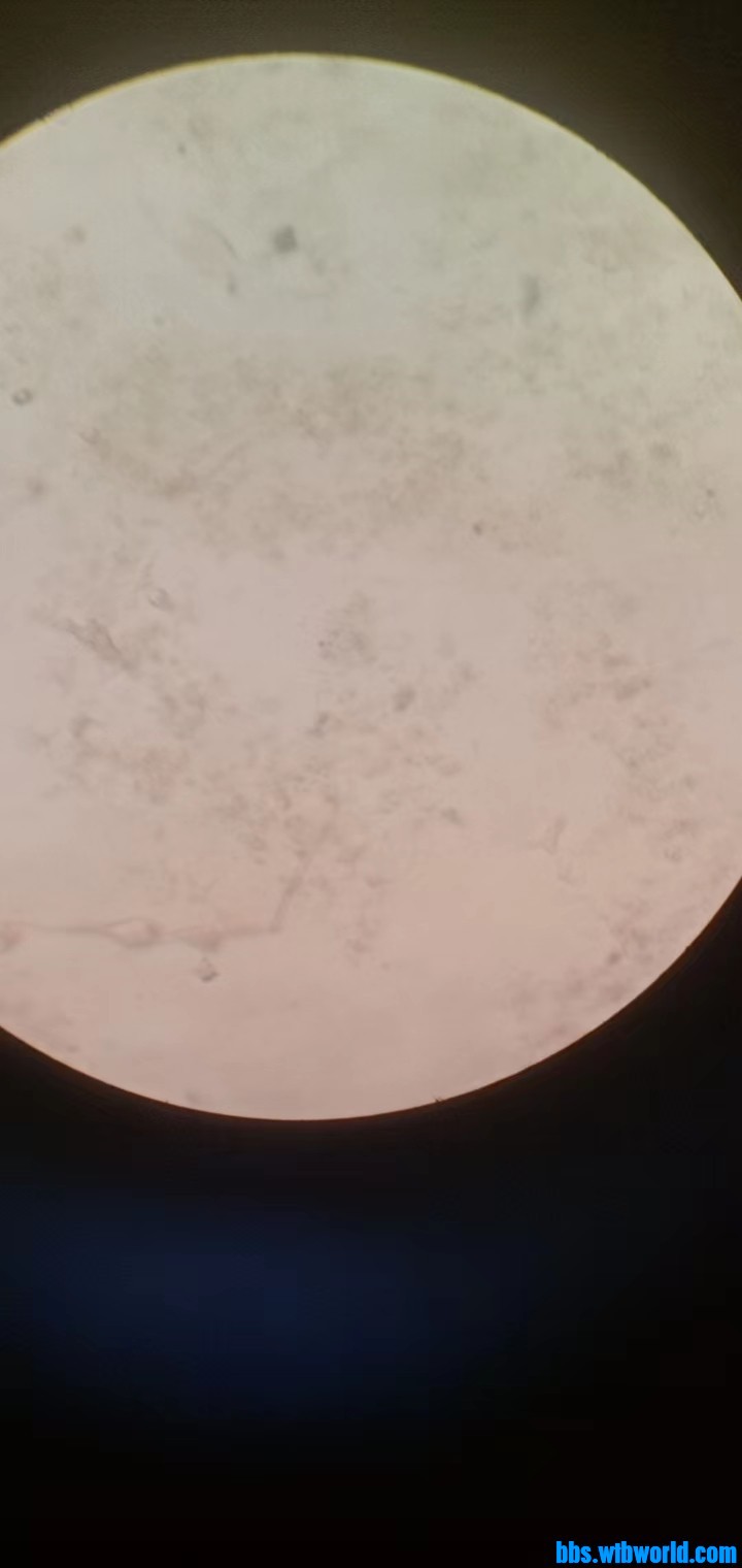 wechat_upload166340886563259ae1308fc