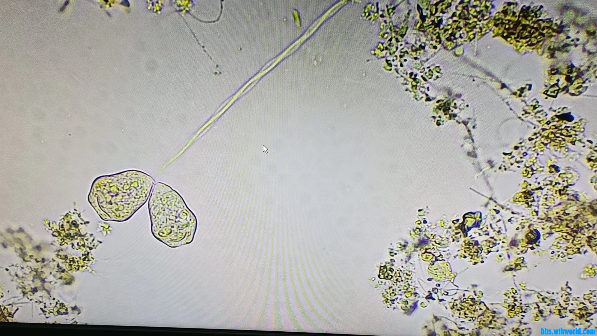 微生物检测方法-革兰氏染色法