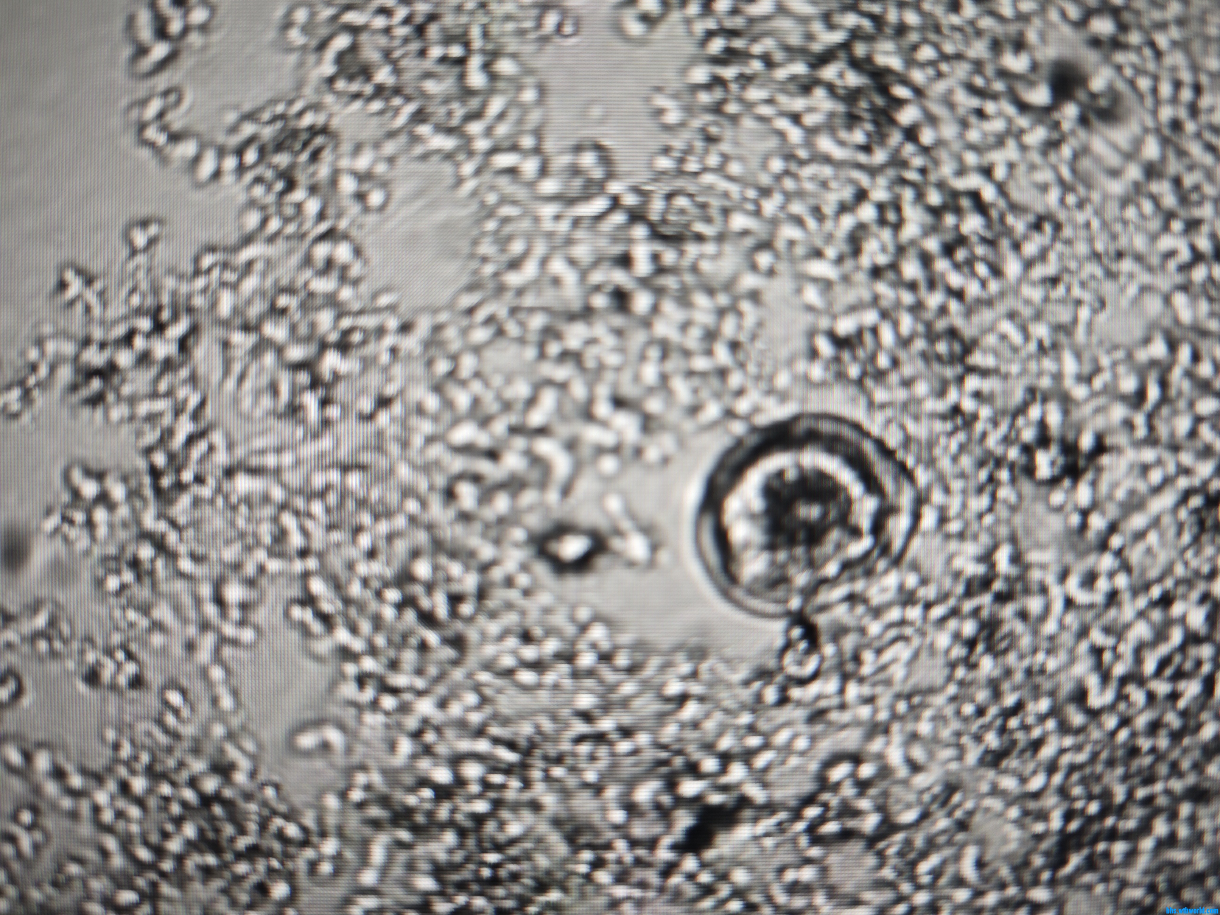 图2 这是表壳虫吗