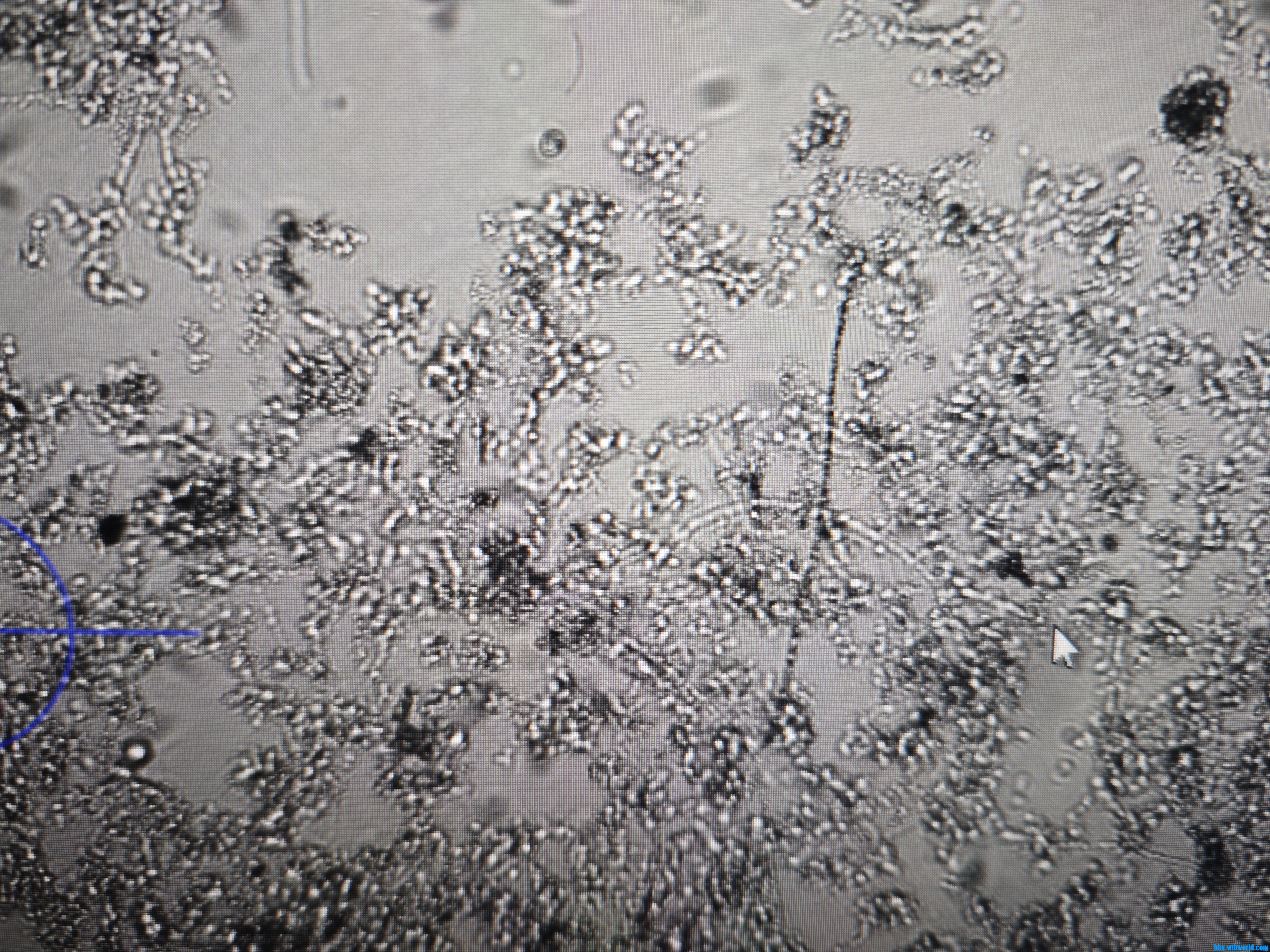 图8 这是线虫吗？活着的，还能动 